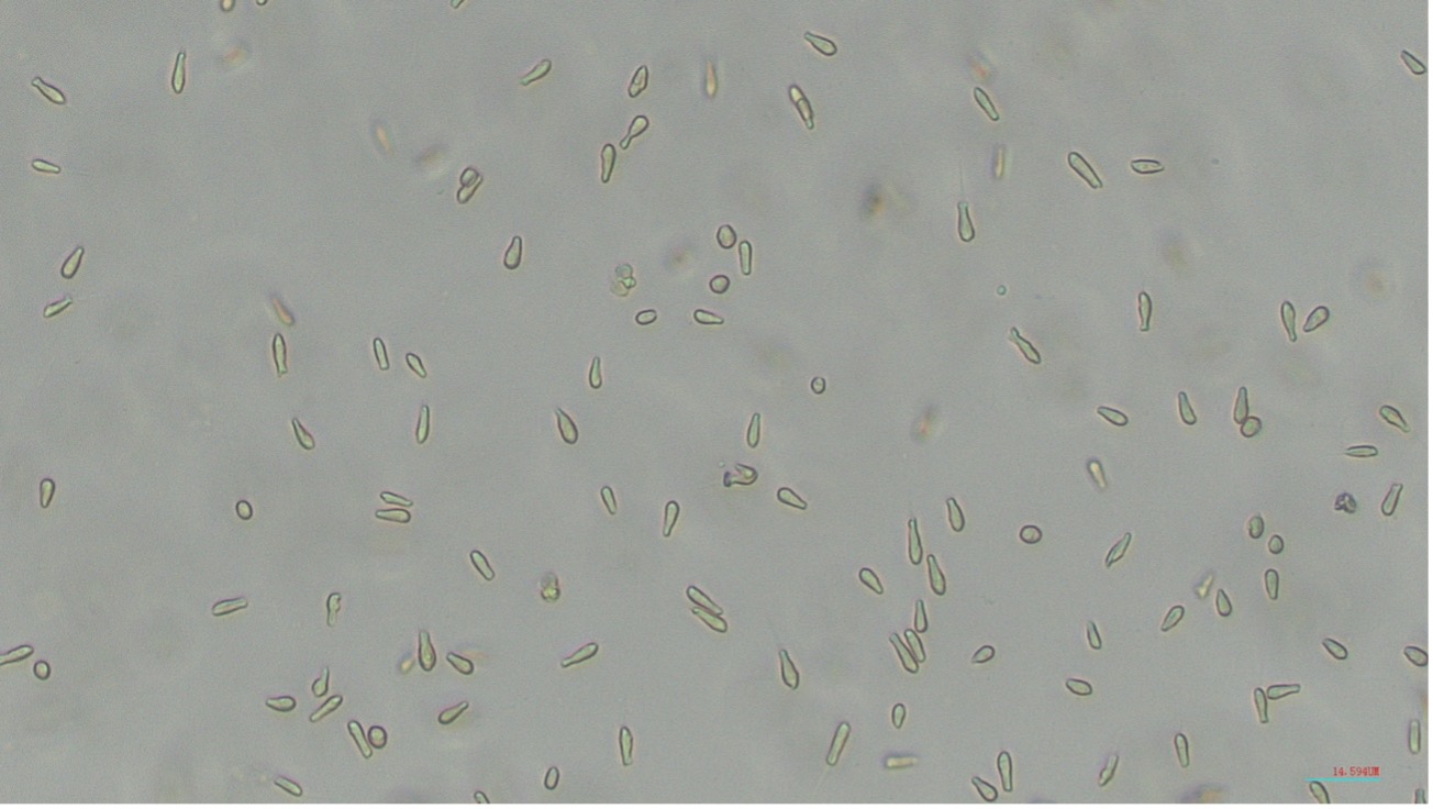 COordination Mechanisms in the Marine Unicellular Nitrogen-fixing ...