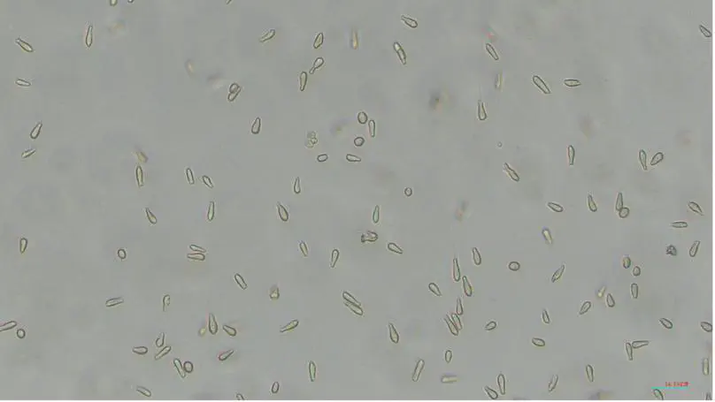 COordination Mechanisms in the Marine Unicellular Nitrogen-fixing cyanobacterium UCYN-A and its Algal Symbiotic partner (COMMUNAS)