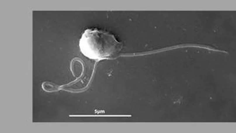 EPIC - Ecological characterization of Picozoa, an abundant and enigmatic protistan group